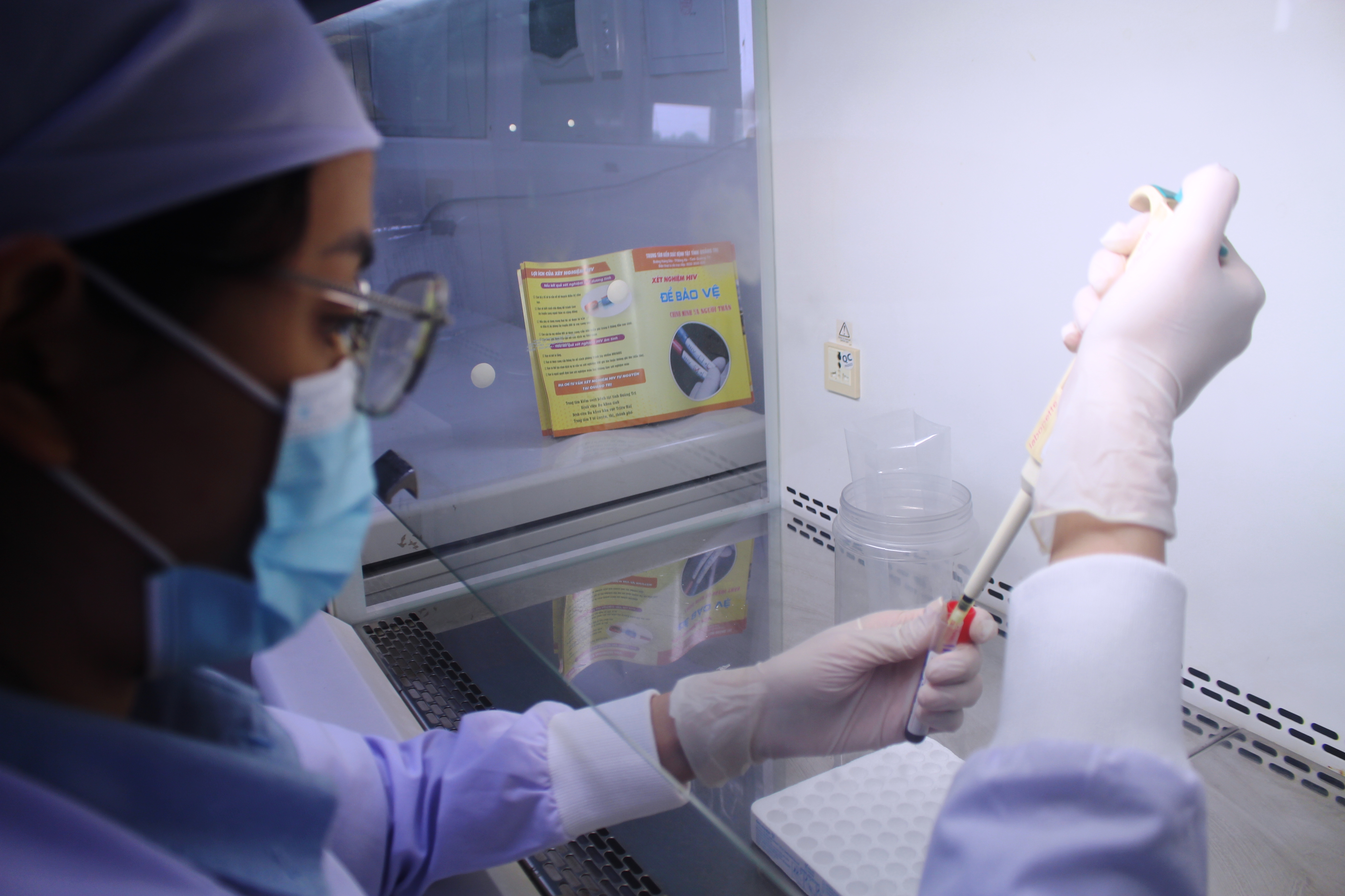 Phát huy vai trò của xét nghiệm khẳng định HIV