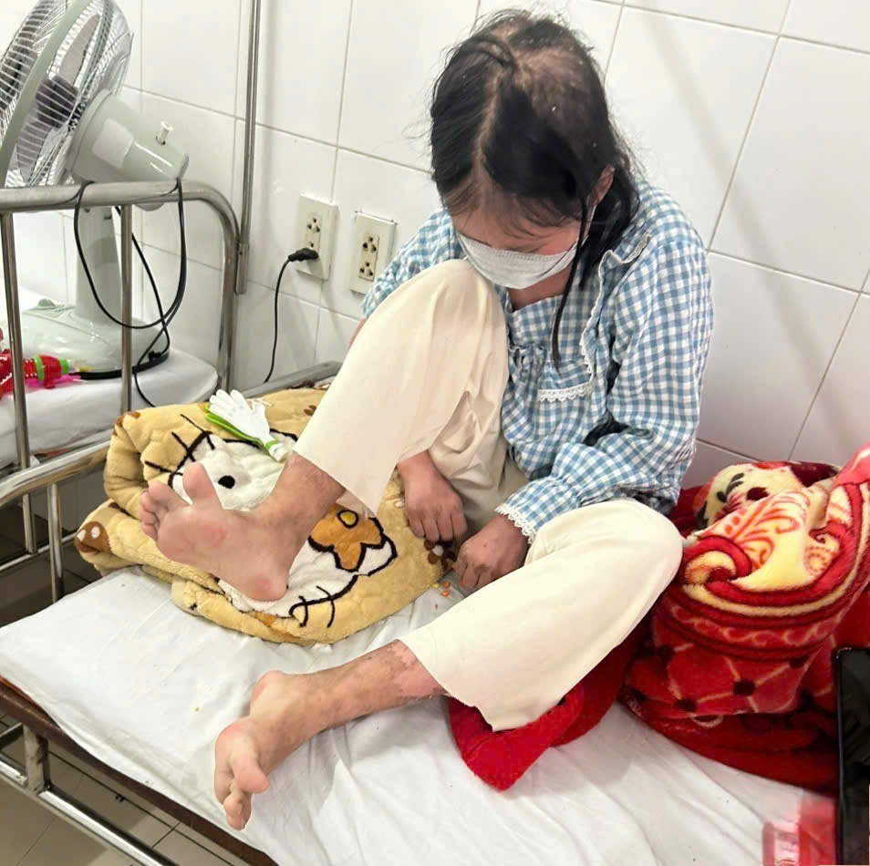 Cô học trò giỏi mắc bệnh hiếm